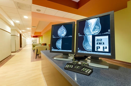 MIT AI Model May Help Eliminate Racial Disparities In Breast Cancer Screenings