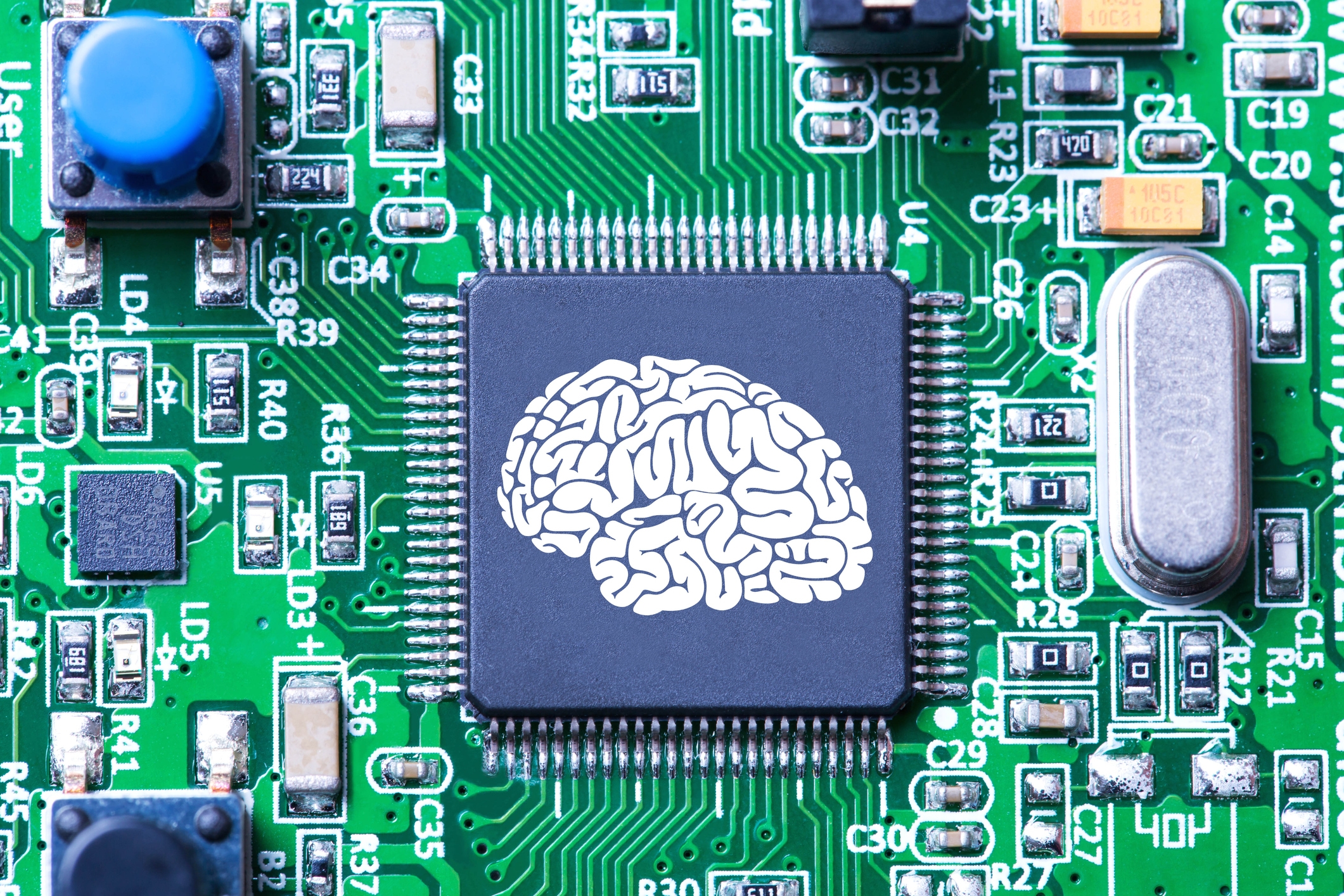 Elon Musk Estimates The Neuralink Brain Chip Human Trials Will Begin Within Six Months