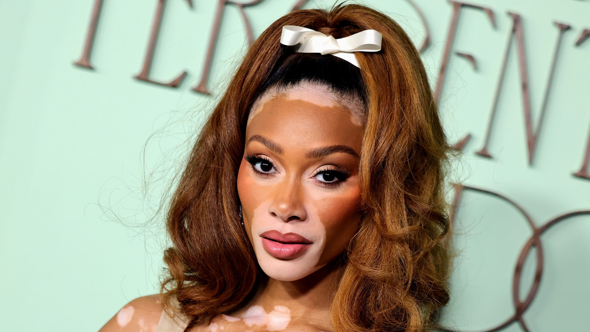 Winnie Harlow Reflects On Raising More Than $6M For Her SPF Skincare Brand Cay Skin — 'When It Came To Even Fundraising, I Still Got A Lot Of No's'